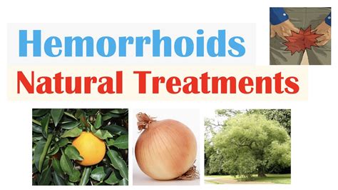 anal plant|Hemorrhoids, plants to treat piles .